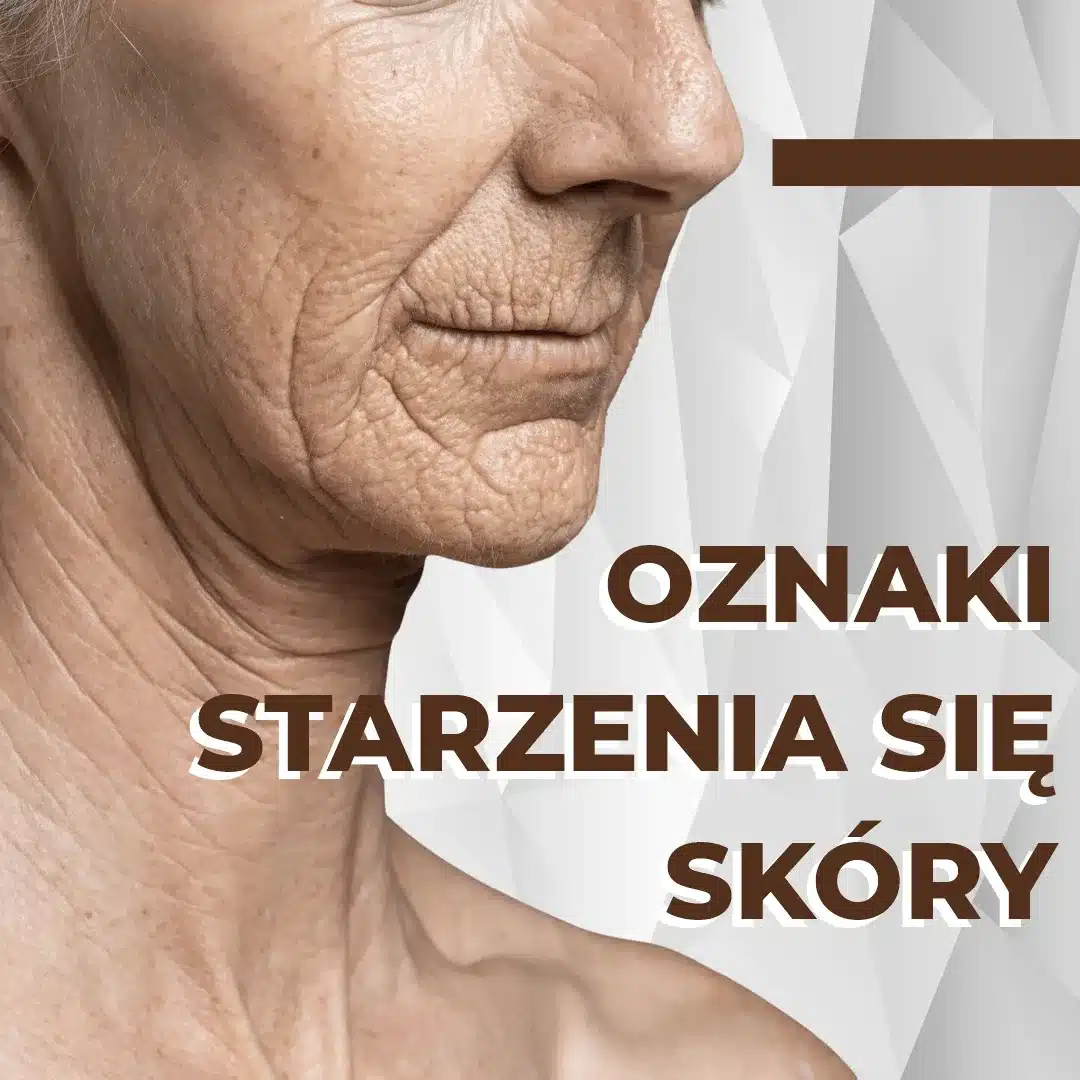 Oznaki starzenia się skóry